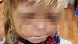 "Избил старший брат". Девочек-маугли нашли в Усть-Каменогорске