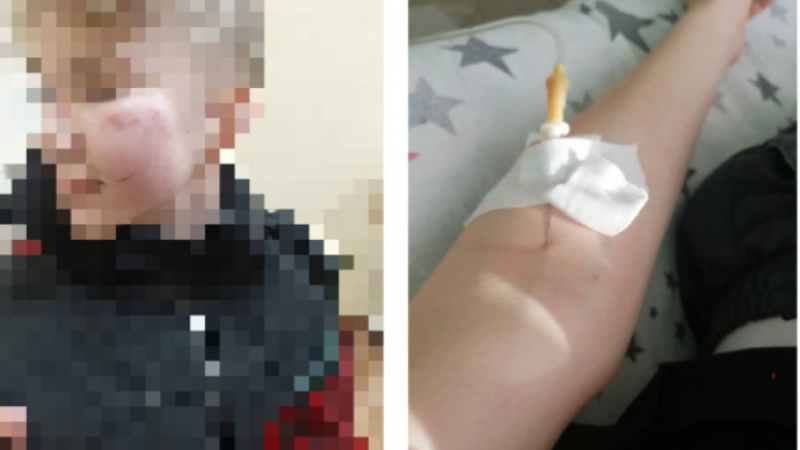 Сверстники жестоко избили семиклассника в Экибастузе