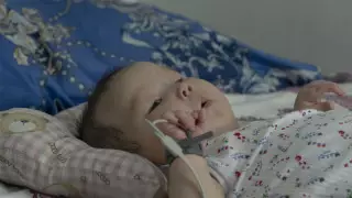 Девочка из ЗКО получила самый дорогой укол в мире