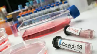 Женщина заразилась COVID-19 дважды за рекордных 20 дней