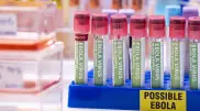Второй пациент с Эболой умер в Конго