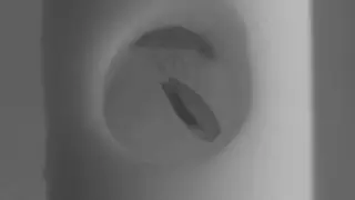 Создан микроробот, устраняющий кровоизлияние в мозг