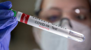 Симптомы COVID-19 сохраняются у каждого пятого переболевшего - исследование