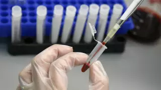 Случай заражения бубонной чумой выявили в Китае