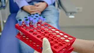 Казахстан закупил тесты для выявления оспы обезьян