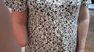 Сотрудница кондитерской фабрики "Рахат" получила 30 миллионов тенге за оторванную руку