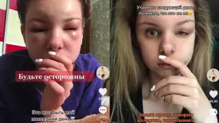 Шокирующие последствия похода в салон красоты показала алматинка