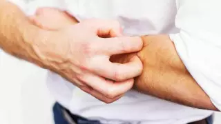 Грибок и чесотка: алматинские врачи рассказали, что можно "подцепить" в примерочных