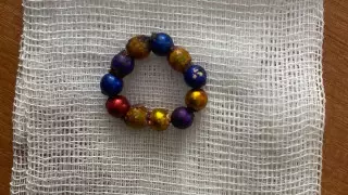 11 магнитов проглотил двухлетний малыш в Караганде