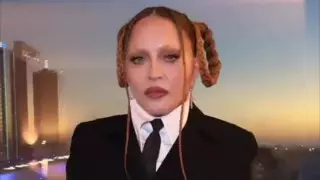 Все так плохо? Мадонна резко отреагировала на критику ее "надутой" внешности