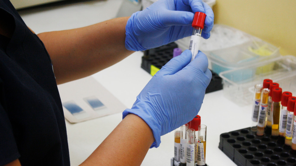 Подъем вирусного гепатита А в Астане спрогнозировали эпидемиологи