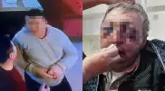 "Ногами по голове и ребрам". Пожилого охранника жестоко избили в Шымкенте