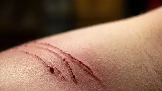 Названа главная опасность кошачьих царапин для человека