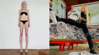 Модель пошла на жуткую операцию ради роста - результат раскритиковали в сети