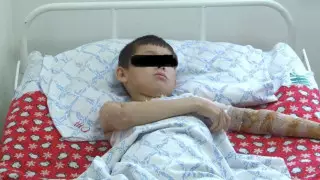 10-летний мальчик после удара током лишился ноги в Туркестанской области