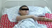 10-летний мальчик после удара током лишился ноги в Туркестанской области