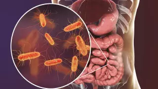 Сальмонеллез и гепатит А: самый опасный салат назвали казахстанские санврачи