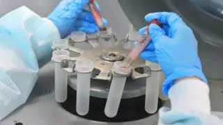 Досаев прокомментировал выявление ВИЧ у пациентов в больнице Алматы