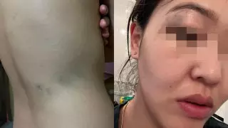 “Избил меня и моего отца“: алматинка пожаловалась на преследования бывшего парня