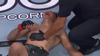 Ветеран UFC Тони Фергюсон потерпел шестое поражение подряд