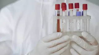 Ситуация нестабильная: в Алматы растет количество заболевших корью