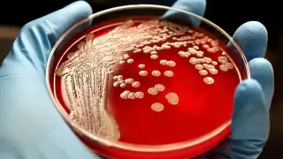 В Акмолинской области 15 человек заболели сибирской язвой