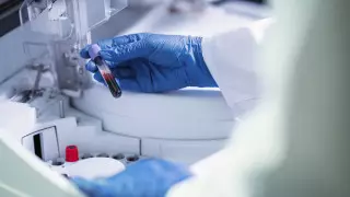 "Ожидаем ухудшения ситуации": заболеваемость корью среди детей растет в Актобе