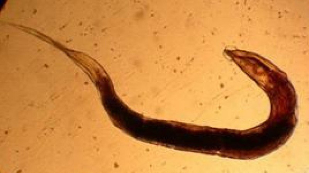 Опасных паразитических червей нашли в организме более сотни жителей ЗКО