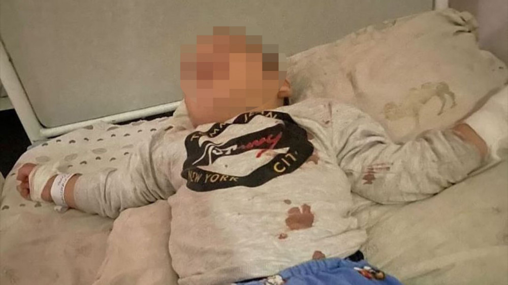 Ребенку чуть не оторвало палец на детской площадке в Кызылорде