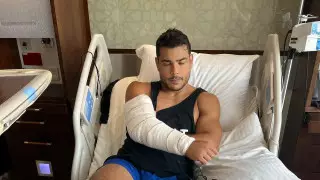 Жуткое фото. Экс-соперник Чимаева показал, почему снялся с боя