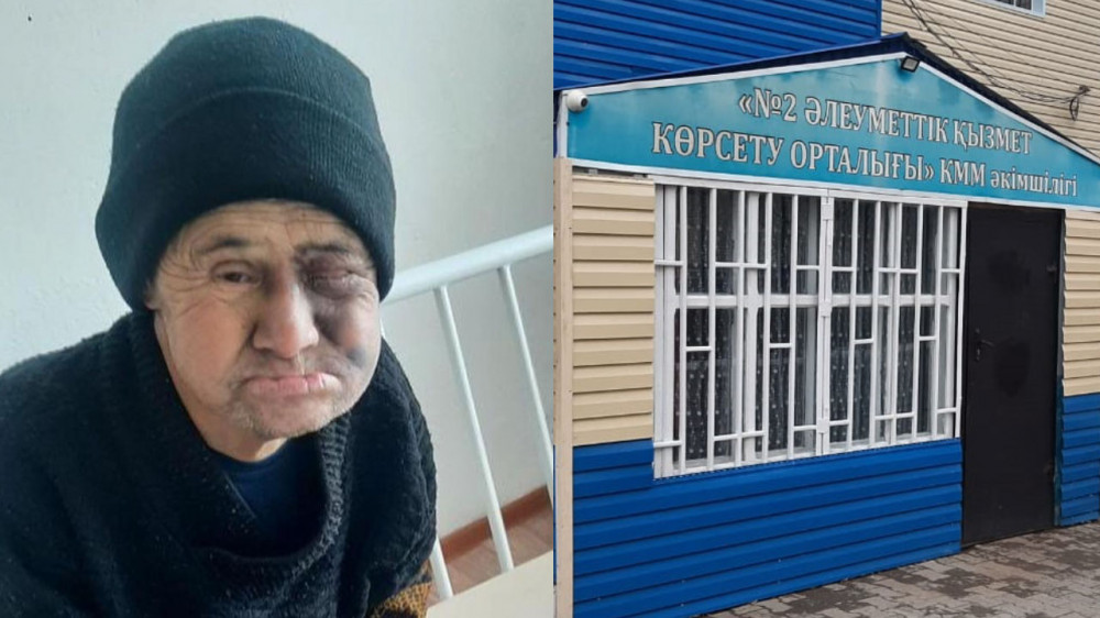 Казахстанец пострадал в спеццентре при странных обстоятельствах: появились подробности
