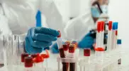 Корь в школах и вузах и условия для карантина прокомментировали министры
