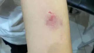 Школьника укусила собака во время урока физкультуры в Актау