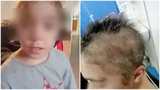 "Обжигала и выкручивала уши": избиение девочки опекуном расследуют в Алматинской области