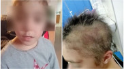 "Обжигала и выкручивала уши": избиение девочки опекуном расследуют в Алматинской области