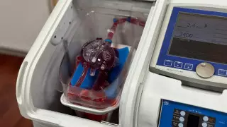 Новое сердце: сколько казахстанцев нуждаются в пересадке