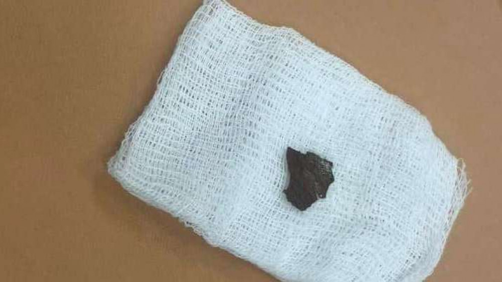 11-месячный ребенок проглотил кусок плинтуса в Мангистау