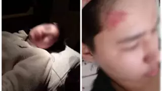 Группа подростков избила на улице 14-летнего инвалида в Мангистауской области