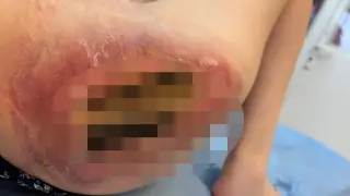 "Дырки останутся на всю жизнь": озвучены итоги проверки по делу астанчанки