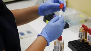 В Казахстане зафиксирован рост заболеваемости гепатитом А