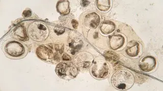 Врач рассказал, что будет, если съесть рыбу с паразитами