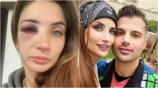 "Я боюсь за свою жизнь". Казахстанская волейболистка рассказала о последствиях избиения