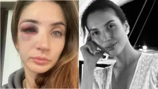 Избитая парнем-иностранцем волейболистка высказалась в поддержку семьи Салтанат Нукеновой