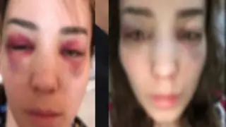 "Жила в аду": казахстанка сравнила насилие в своей семье с делом Бишимбаева