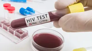 Скандал с заражением ВИЧ в Алматы: о новой работе уволенного главврача рассказали в Минздраве