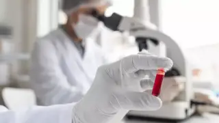 Каким способом казахстанцы чаще всего заражаются ВИЧ