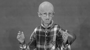 Скончался самый известный человек с синдромом преждевременного старения
