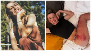 Красотка-чемпионка “Тур де Франс“ попала в жуткую аварию: фото