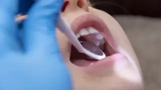 Казахстанец отказался оплачивать брекеты сыну: суд встал на его сторону