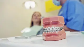 Брекеты - мода или необходимость? Как не ошибиться с выбором врача